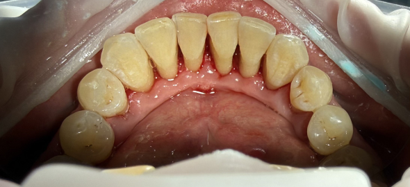 После